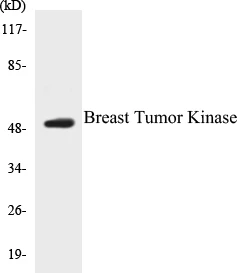 Breast Tumor Kinase Cell Based ELISA Kit (A103354-96)