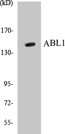 ABL1 Cell Based ELISA Kit (A103211-96)