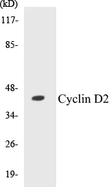 Cyclin D2 Cell Based ELISA Kit (A102932-96)