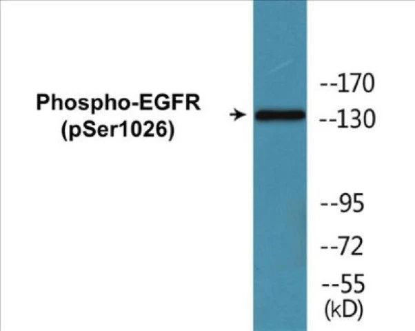 EGFR (phospho Ser1026) Cell Based ELISA Kit (A102211-296)