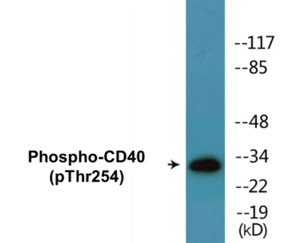 CD40 (phospho Thr254) Cell Based ELISA Kit (A102652-296)