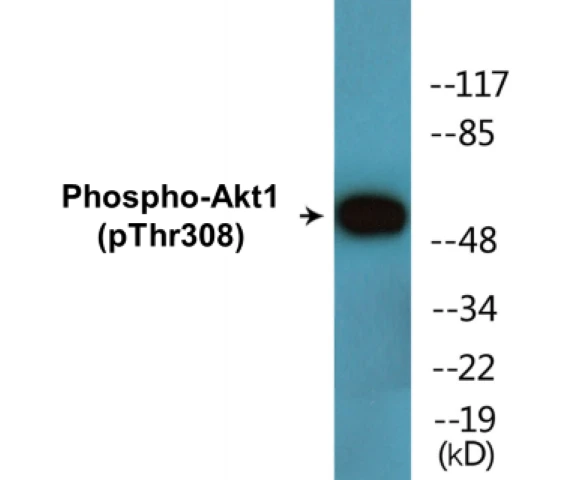 Akt1 (phospho Thr308) Cell Based ELISA Kit (A102360-296)