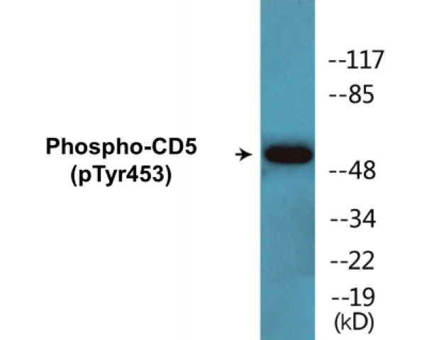 CD5 (phospho Tyr453) Cell Based ELISA Kit (A102400-296)