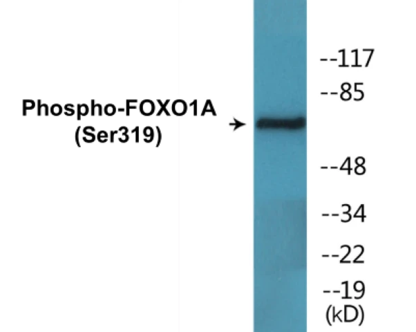 FOXO1A (phospho Ser319) Cell Based ELISA Kit (A102085-296)