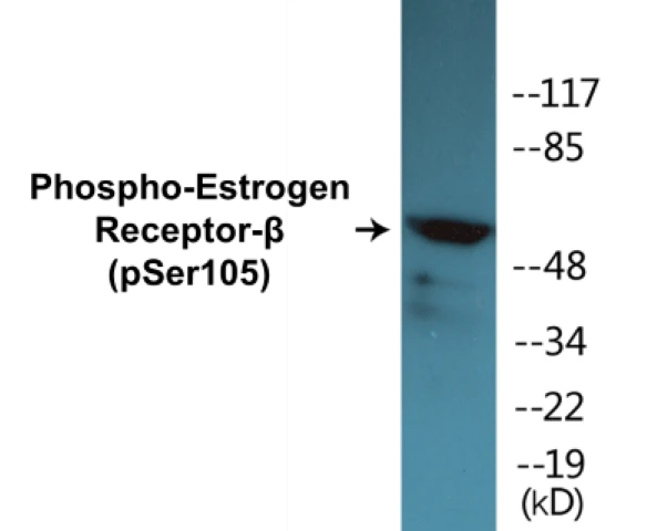 Estrogen Receptor beta (phospho Ser105) Cell Based ELISA Kit (A102229-296)