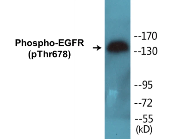 EGFR (phospho Thr678) Cell Based ELISA Kit (A102285-296)