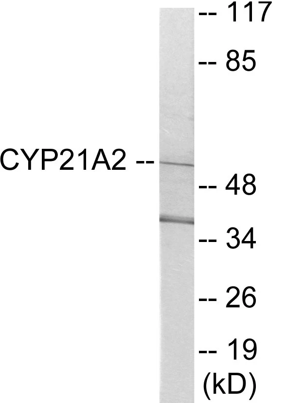 Cytochrome P45 021A2 Cell Based ELISA Kit (A103596-96)