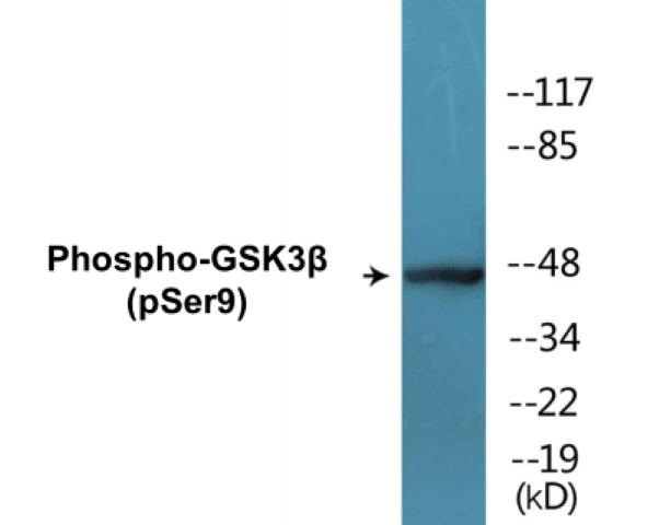 GSK3 beta (phospho Ser9) Cell Based ELISA Kit (A102051-296)