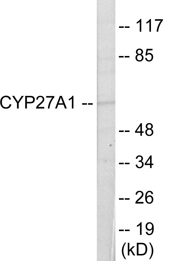 Cytochrome P45 027A1 Cell Based ELISA Kit (A103598-96)