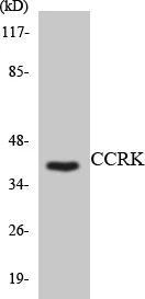 CCRK Cell Based ELISA Kit (A103301-96)