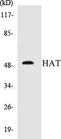 HAT Cell Based ELISA Kit (A103320-96)