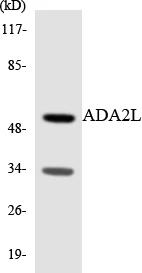 ADA2L Cell Based ELISA Kit (A103135-96)