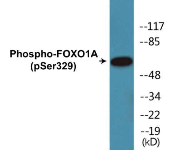 FOXO1A (phospho Ser329) Cell Based ELISA Kit (A102082-296)