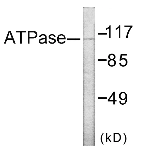 ATPase Cell Based ELISA Kit (A103030-96)