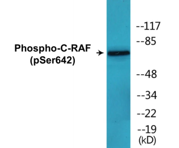 C-RAF (phospho Ser642) Cell Based ELISA Kit (A102222-296)