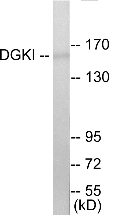 DGKI Cell Based ELISA Kit (A103588-96)