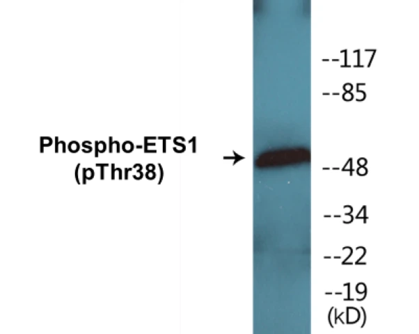 ETS1 (phospho Thr38) Cell Based ELISA Kit (A103827-296)