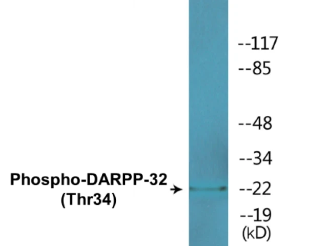 DARPP-32 (phospho Thr34) Cell Based ELISA Kit (A102046-296)