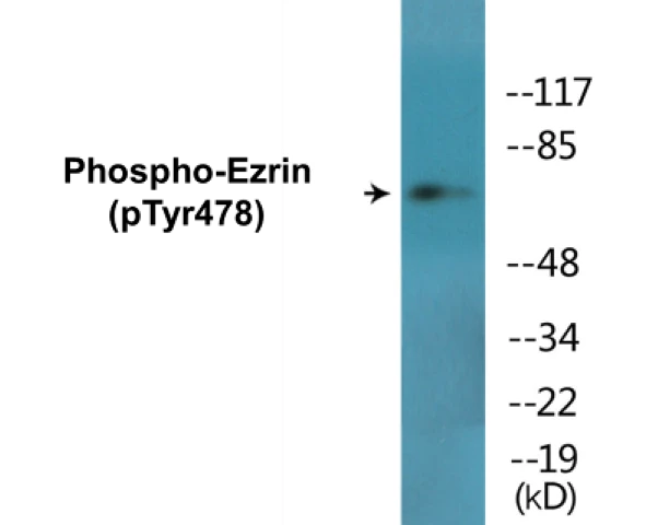 Ezrin (phospho Tyr478) Cell Based ELISA Kit (A102213-296)