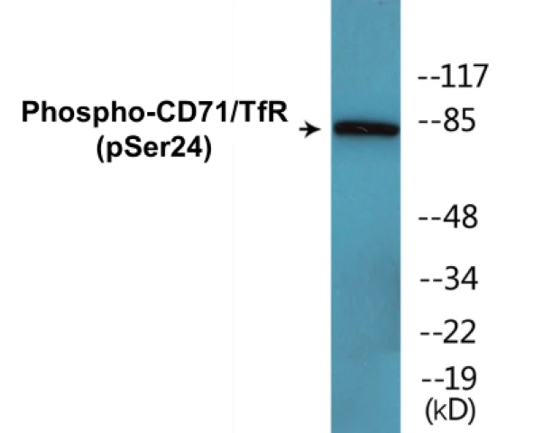 CD71 (phospho Ser24) Cell Based ELISA Kit (A102664-296)