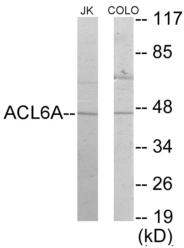 ACTL6A Cell Based ELISA Kit (A103021-96)