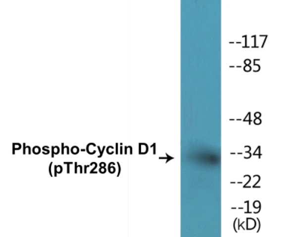 Cyclin D1 (phospho Thr286) Cell Based ELISA Kit (A102528-296)