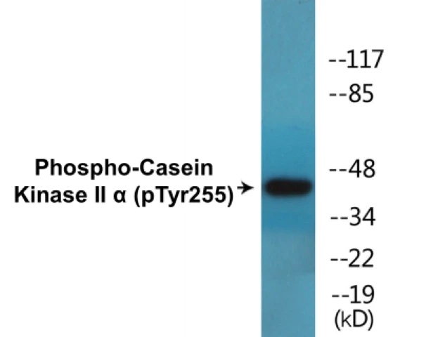 Casein Kinase II alpha (phospho Tyr255) Cell Based ELISA Kit (A102231-296)