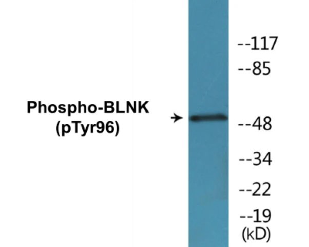 BLNK (phospho Tyr96) Cell Based ELISA Kit (A102662-296)