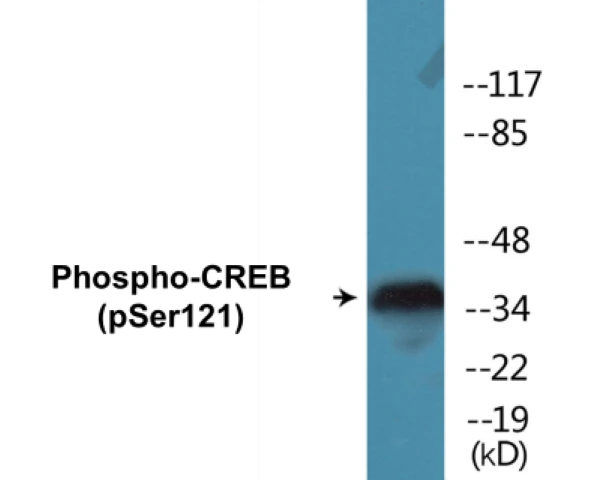 CREB (phospho Ser121) Cell Based ELISA Kit (A102294-296)