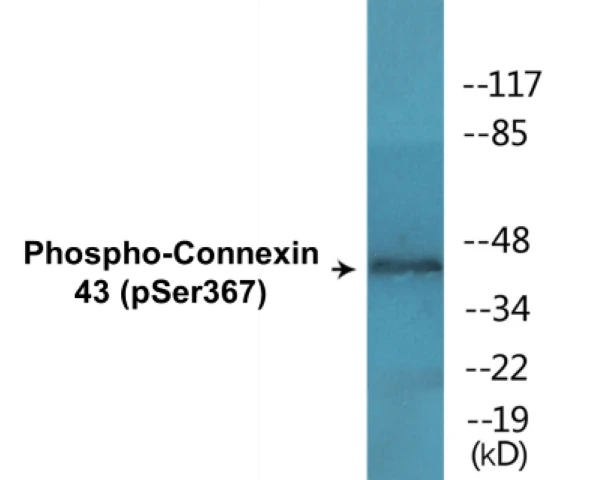 Connexin 43 (phospho Ser367) Cell Based ELISA Kit (A102506-296)