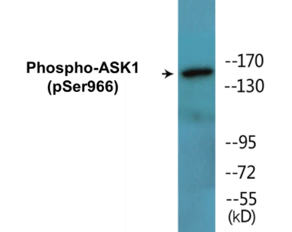 ASK1 (phospho Ser966) Cell Based ELISA Kit (A102251-296)