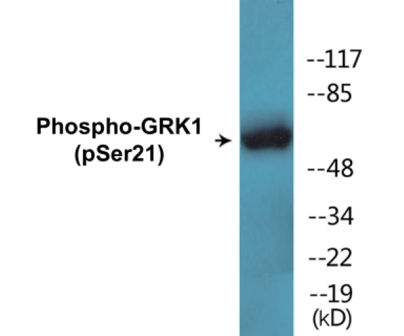 GRK1 (phospho Ser21) Cell Based ELISA Kit (A102430-296)