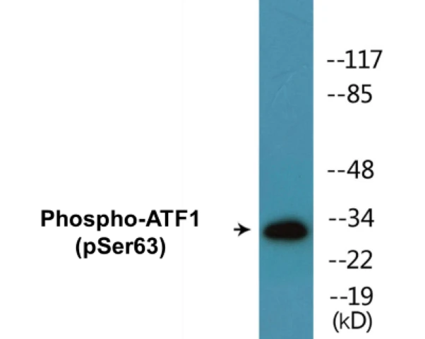 ATF1 (phospho Ser63) Cell Based ELISA Kit (A102667-296)