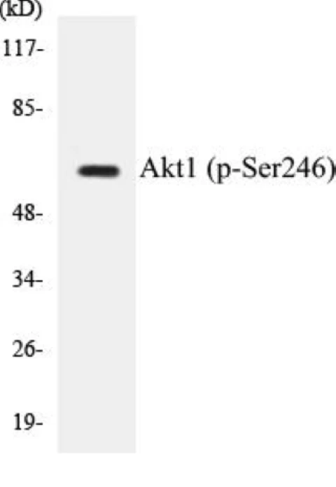 Akt1 (phospho Ser246) Cell Based ELISA Kit (A102300-296)