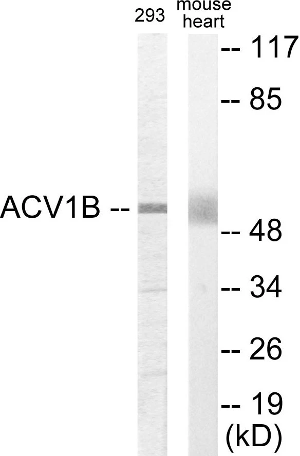 ACV1B Cell Based ELISA Kit (A103145-96)