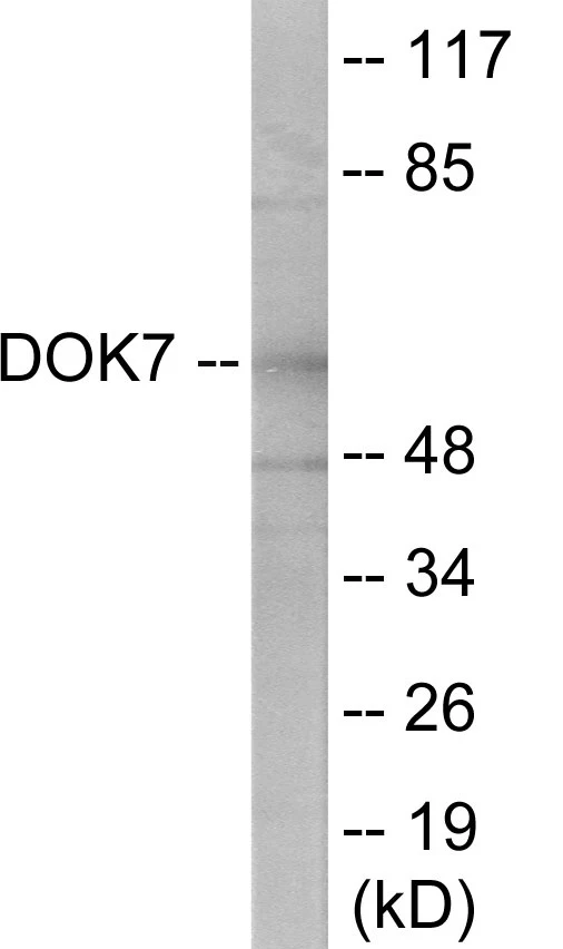 DOK7 Cell Based ELISA Kit (A103552-96)