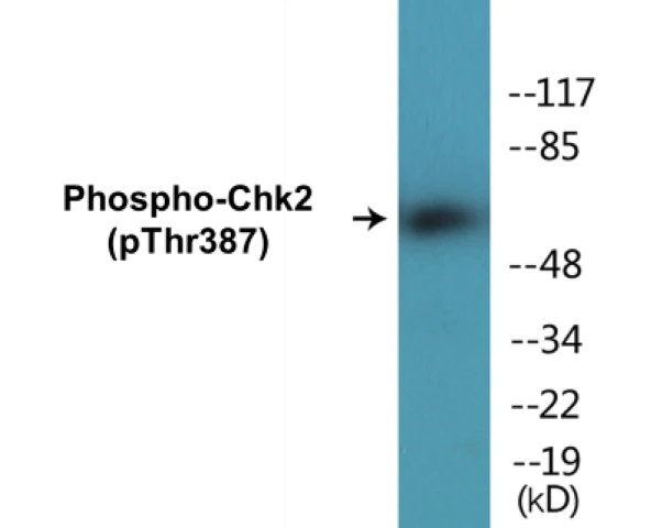 Chk2 (phospho Thr387) Cell Based ELISA Kit (A102274-296)