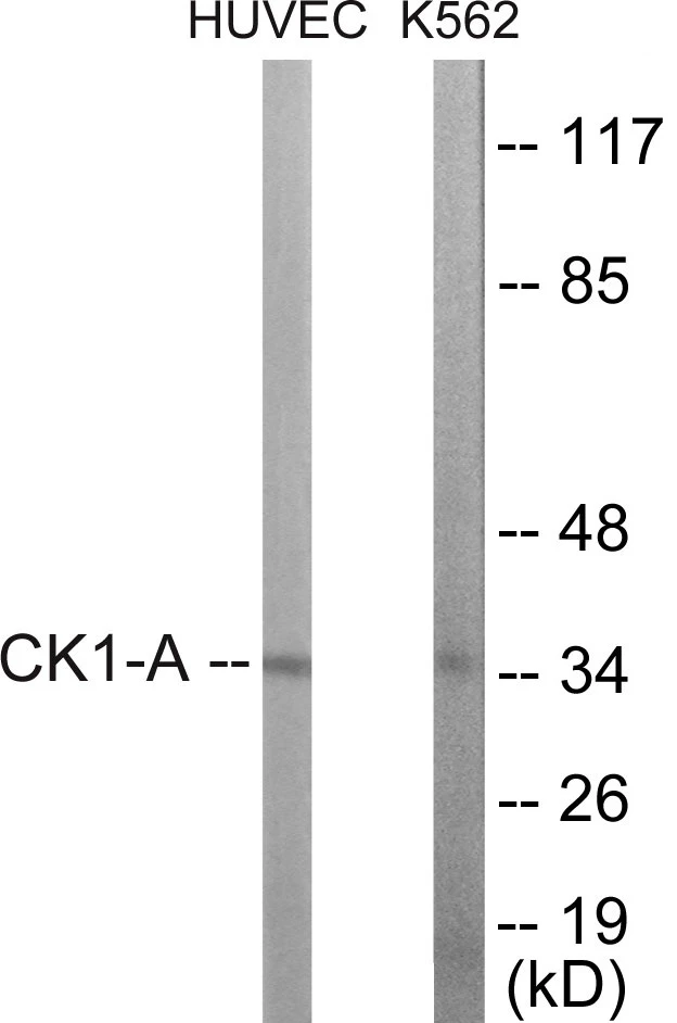 CKI alpha Cell Based ELISA Kit (A102913-96)