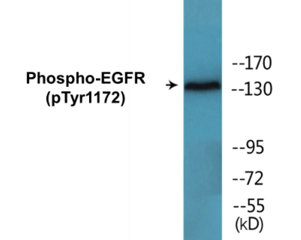 EGFR (phospho Tyr1172) Cell Based ELISA Kit (A102133-296)