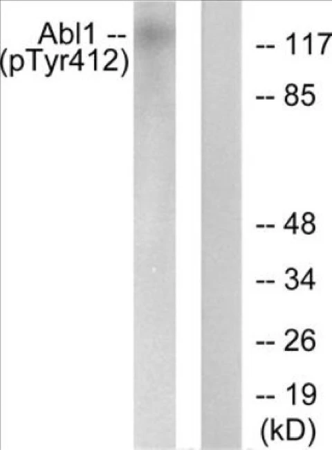 Abl (phospho Tyr412) Cell Based ELISA Kit (A102675-296)