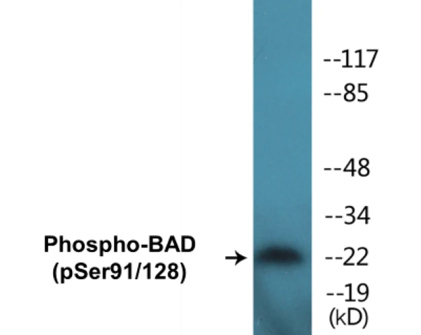 BAD (phospho Ser91 + Ser128) Cell Based ELISA Kit (A102501-296)