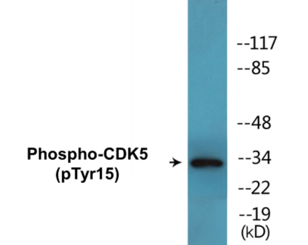 CDK5 (phospho Tyr15) Cell Based ELISA Kit (A102381-296)