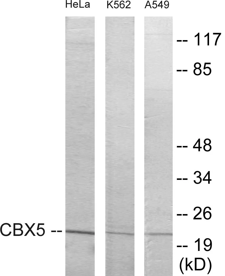 CBX5 Cell Based ELISA Kit (A103513-96)