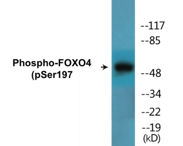 FOXO4 (phospho Ser197) Cell Based ELISA Kit (A102629-296)