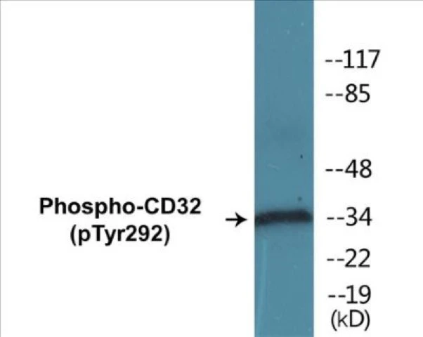 CD32 (phospho Tyr292) Cell Based ELISA Kit (A103815-296)