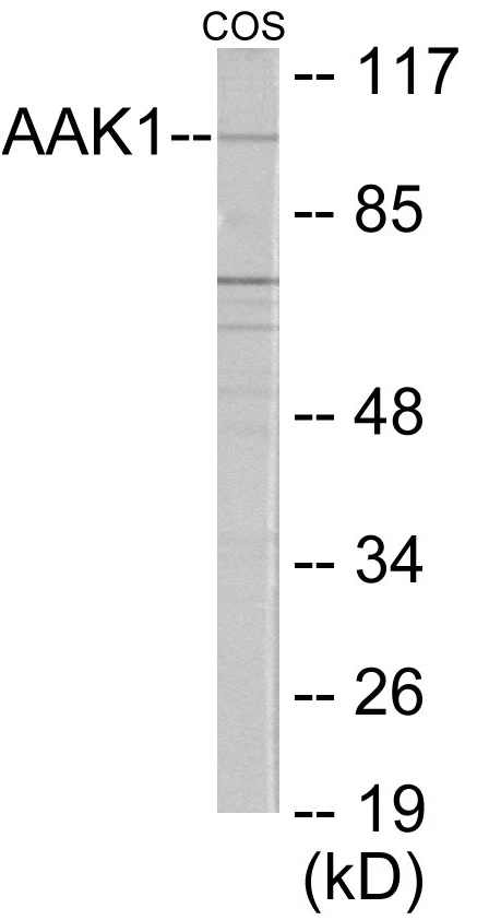 AAK1 Cell Based ELISA Kit (A103298-96)