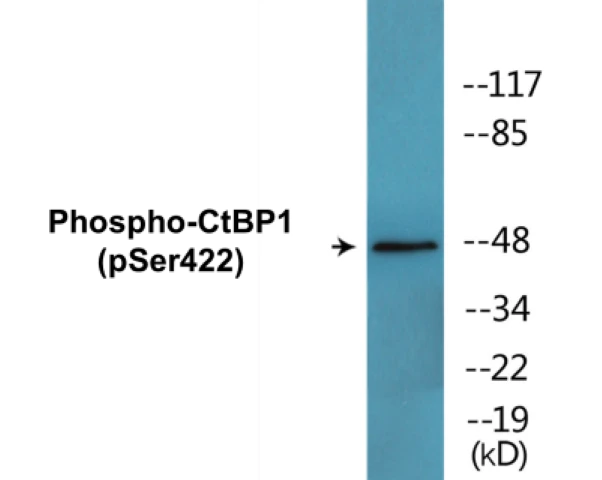 CtBP1 (phospho Ser422) Cell Based ELISA Kit (A102219-296)