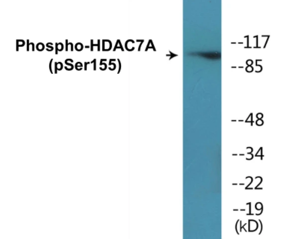 HDAC7A (phospho Ser155) Cell Based ELISA Kit (A102110-296)