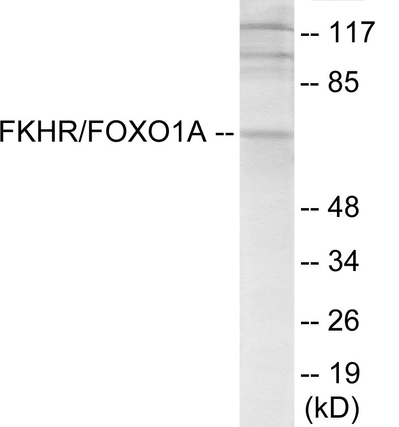 FKHR Cell Based ELISA Kit (A103557-96)