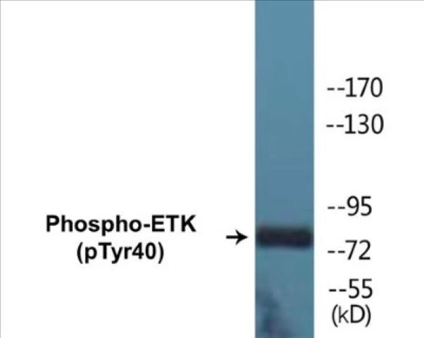 ETK (phospho Tyr40) Cell Based ELISA Kit (A102679-296)